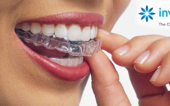Braces & Invisalign