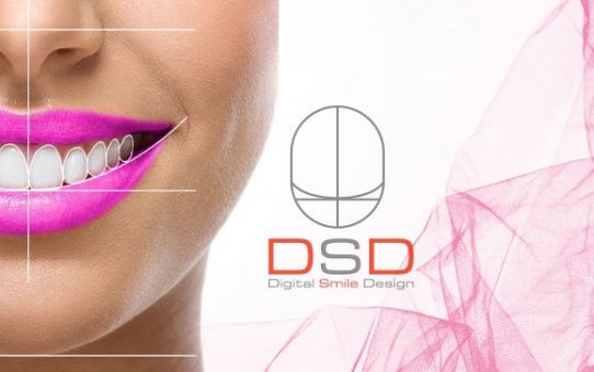 Smile Designing